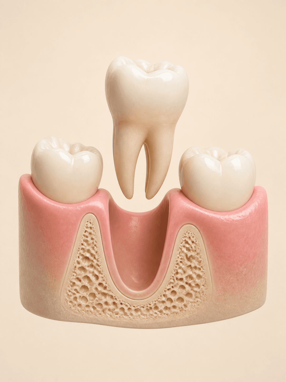 tooth extraction