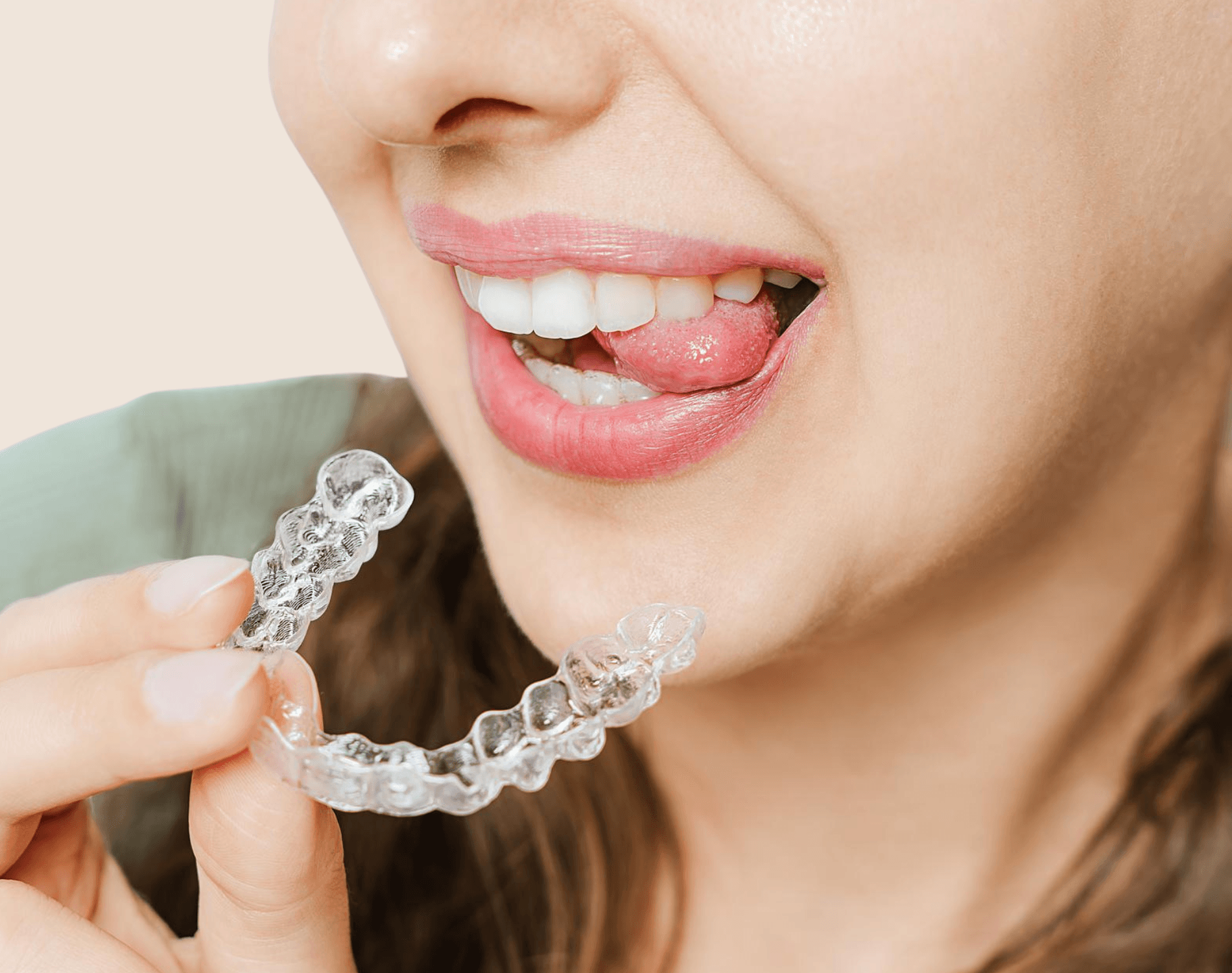 Clear Aligners