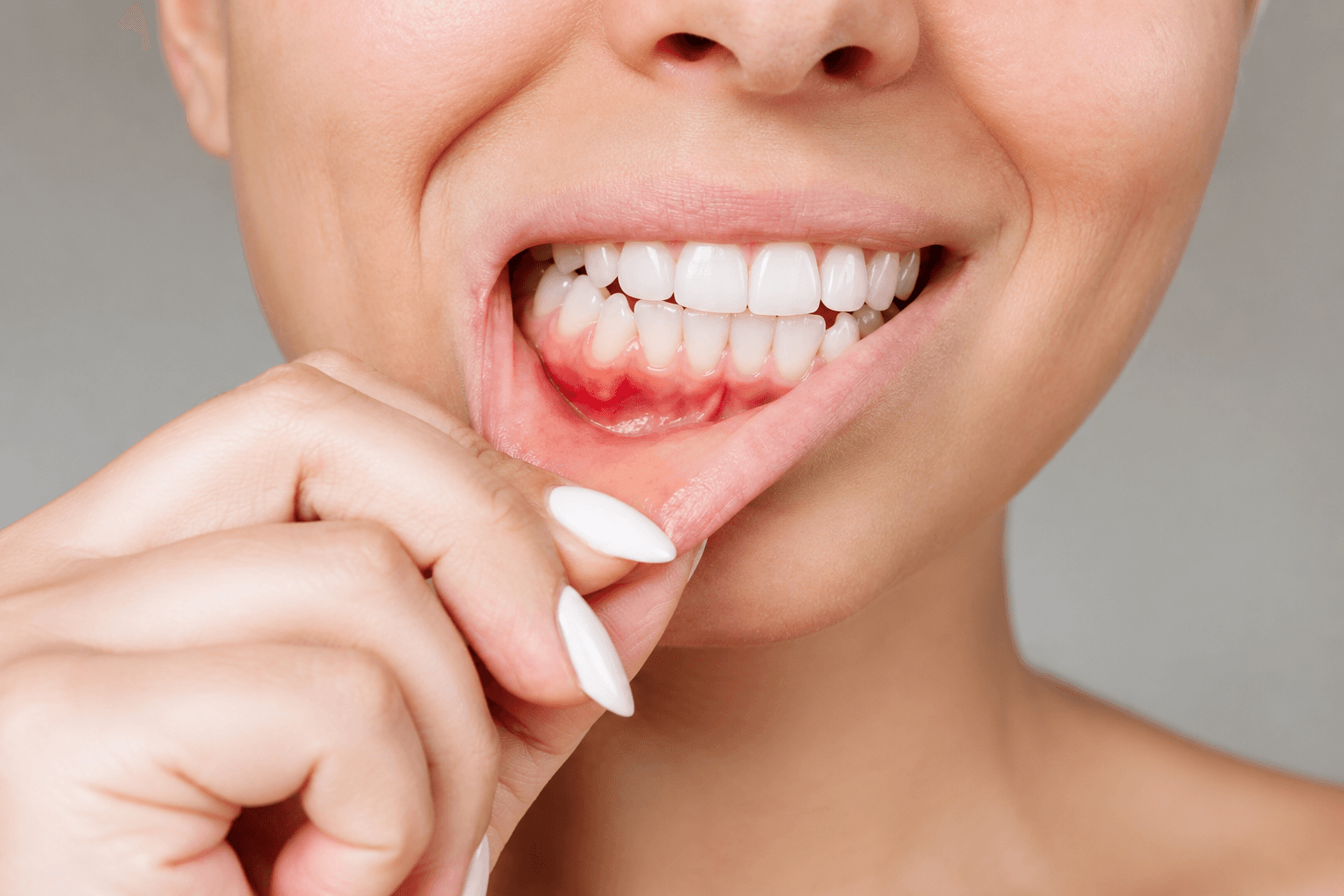 Gum Disease Treatment