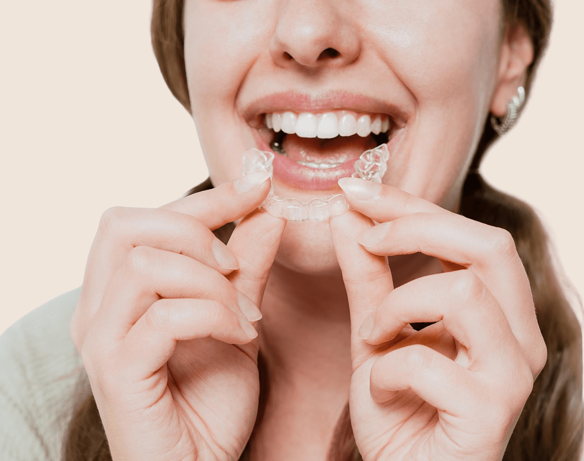 Retainers