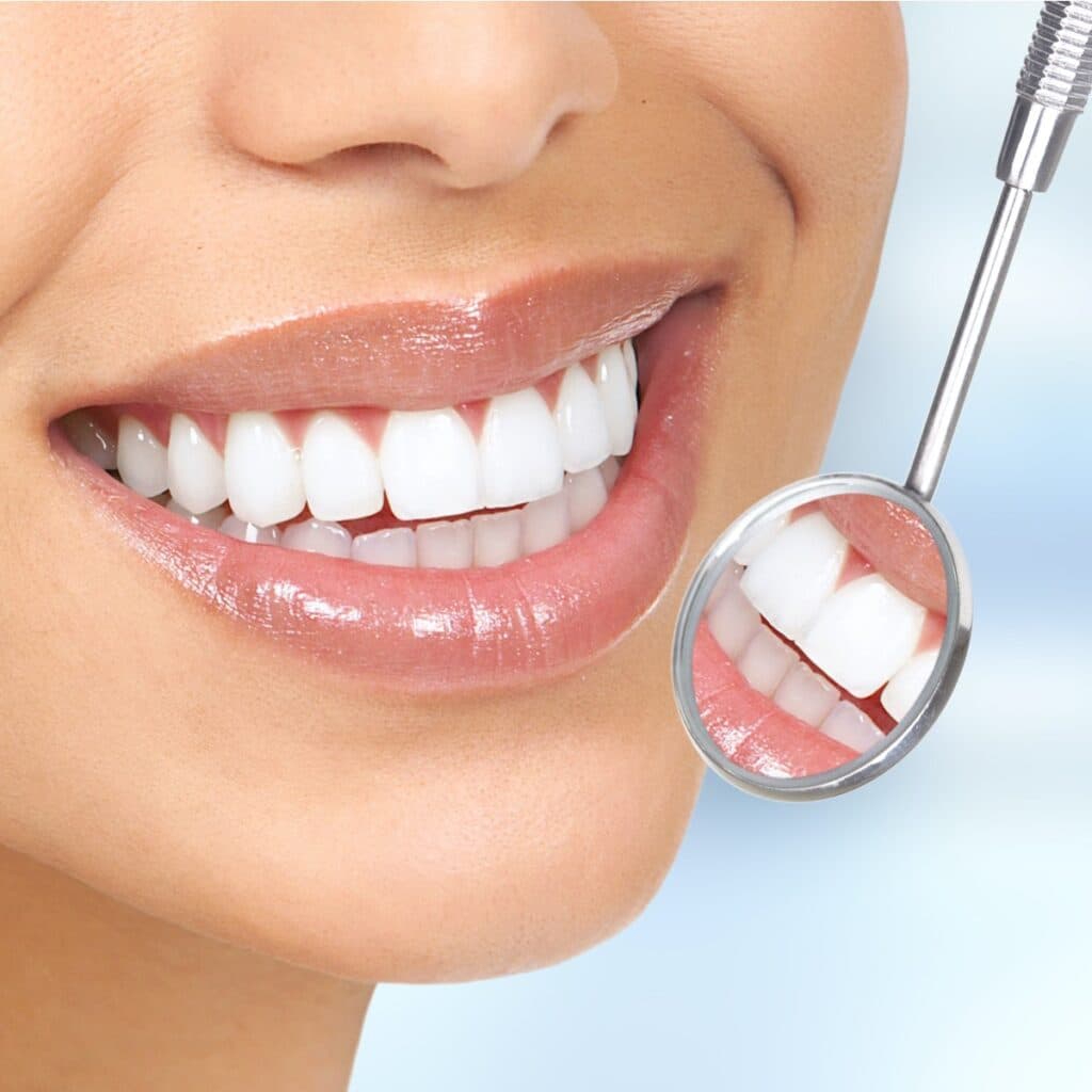 Teeth Cleaning